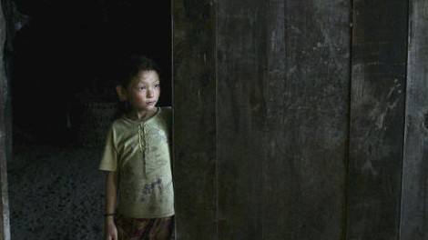 银屑病患者自述康复真实记录,银屑病患者自述真实经历