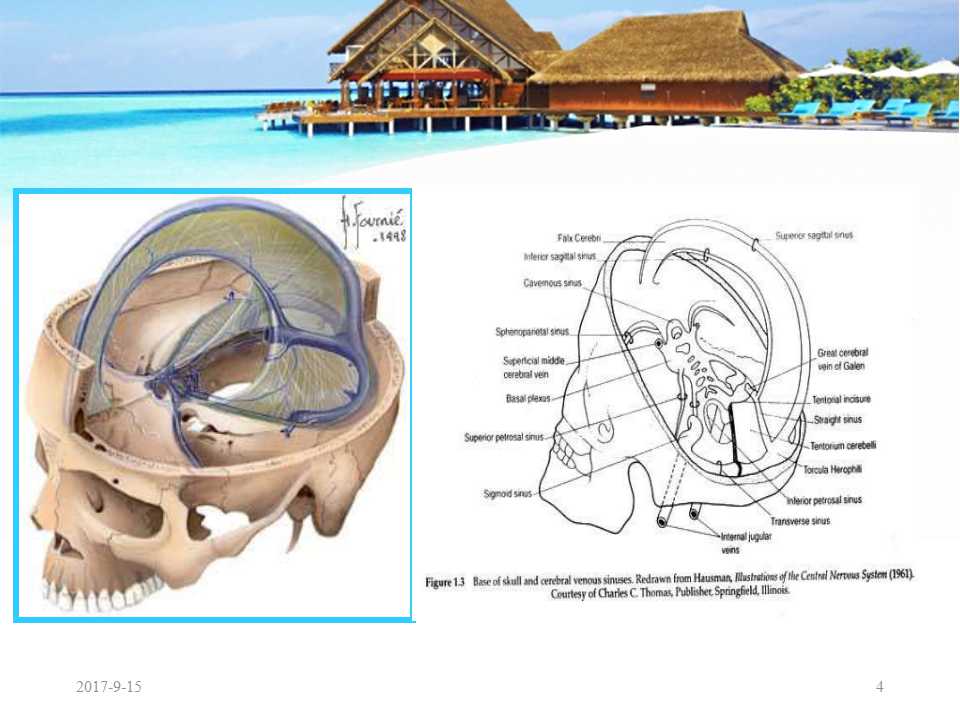 颅内静脉窦血栓形成怎么治疗,颅内静脉窦血栓怎么治疗