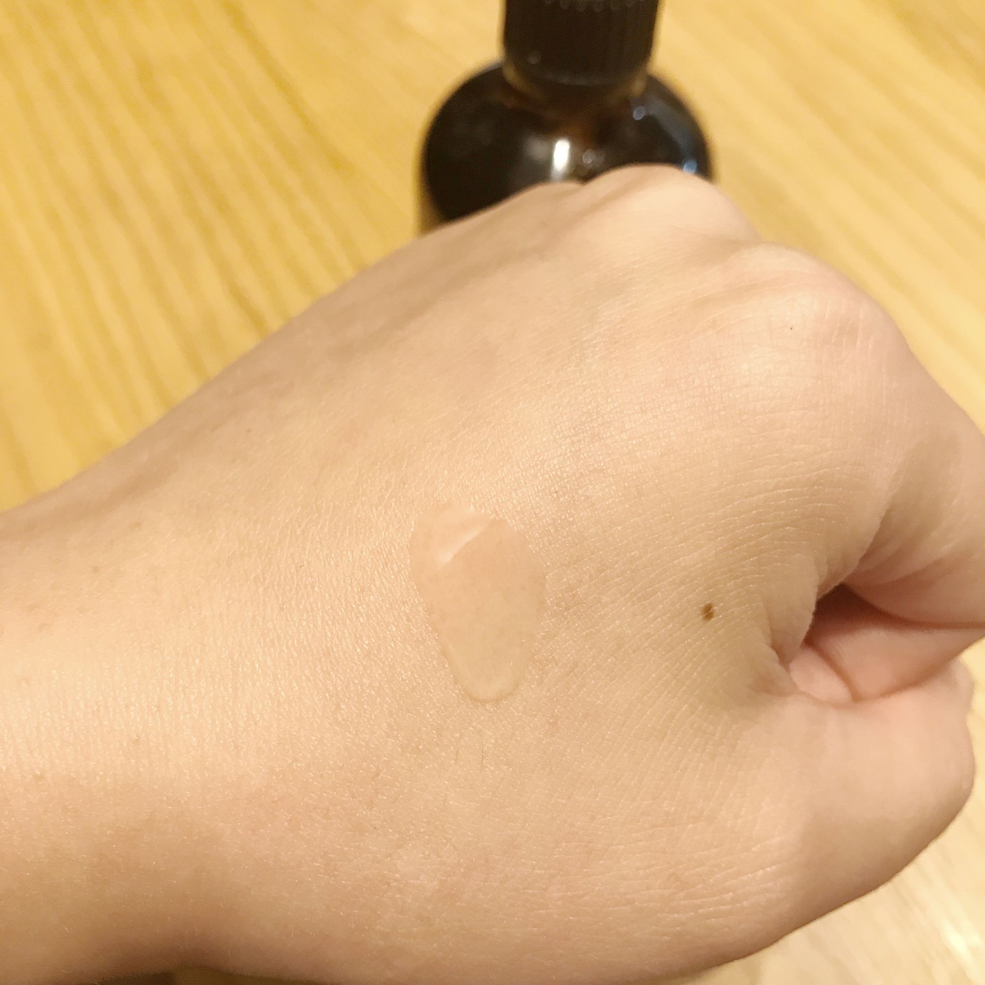 油性痘痘肌用什么精华,痘痘肌怎么选精华水