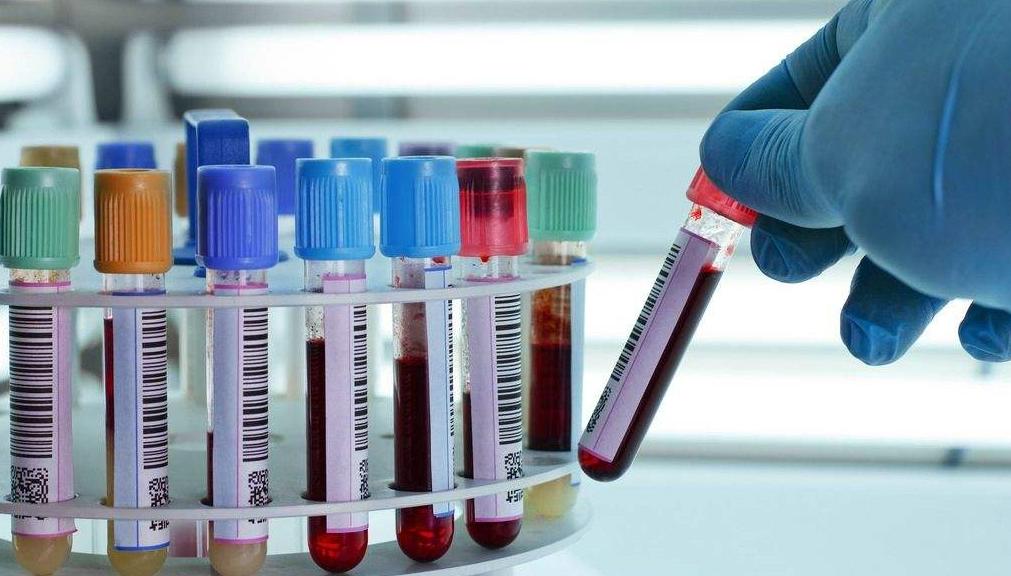 丙肝抗病毒药物,丙肝抗病毒的注意事项