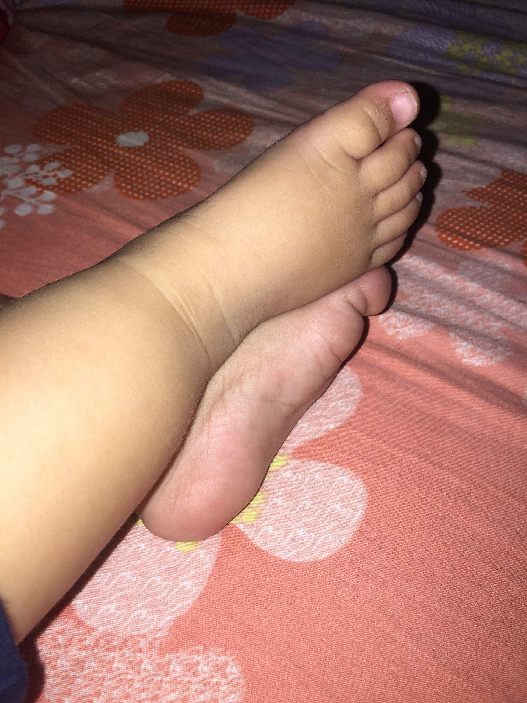 小孩大运动和语言发育迟缓怎么办,大运动发育迟缓3岁宝宝康复训练