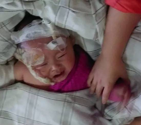 天!福州5个月宝宝被烧成这样!治疗费愁苦了父母,帮帮她吧!