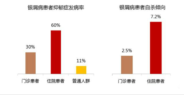 银屑病用了生物制剂又复发,点滴型银屑病复发概率大吗