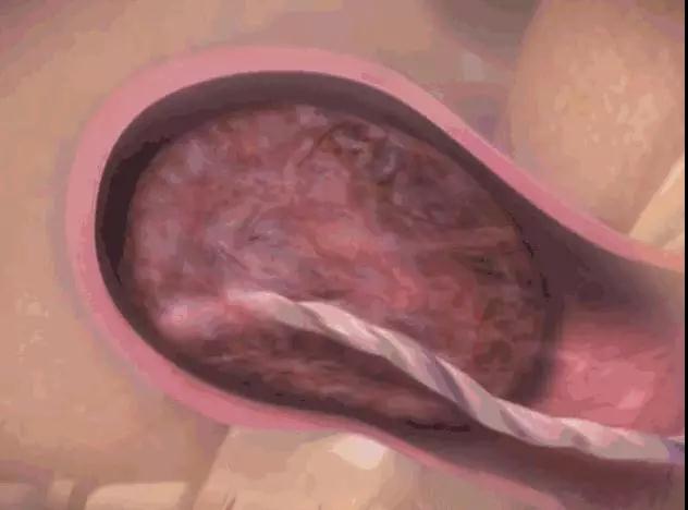 女人生孩子有多痛和疼,生小孩到底有多痛图文