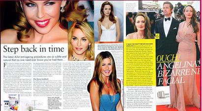 玻尿酸有哪些明星在用,好莱坞女明星玻尿酸