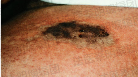 我们真的不想在假期开始前来一期重口味更新的