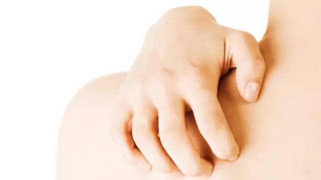 儿童手背丘疹性湿疹用什么药膏,婴儿粟丘疹和湿疹的区别