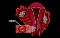 女性哪些妇科疾病需要做微创手术,女性常见的十大妇科疾病症状