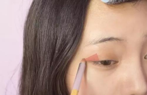 眼角鼻梁塌怎么拯救,鼻梁塌陷怎么补救不手术