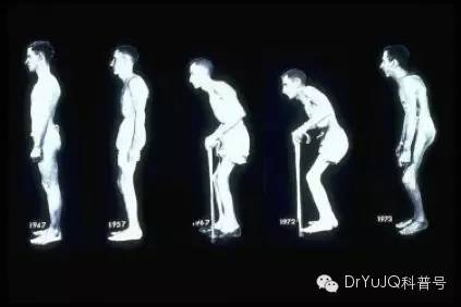 脊柱关节病的科普知识,如何诊断脊柱关节病