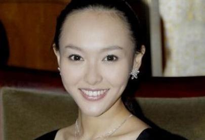 两边发际线后移可以剪短发,拯救你的发际线让头发茂盛起来