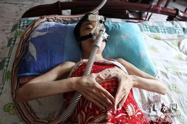 罕见病200万一年,不可治愈的罕见病有哪些