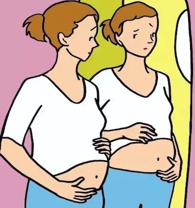 卵巢肿瘤的四种症状,卵巢实性包块的四种症状