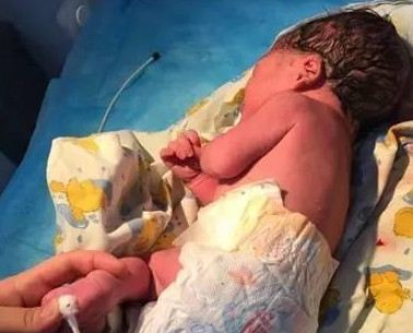 自然分娩会遇到的困难,科普孕妈妈遇急产如何处理