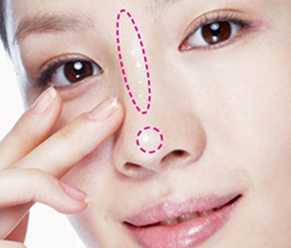 鼻子毛孔粗大泛红用什么药膏,鼻子毛孔粗大发红怎么办