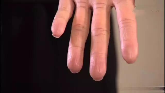 詹姆斯的脚趾头科比的手,科比的手指和脚趾