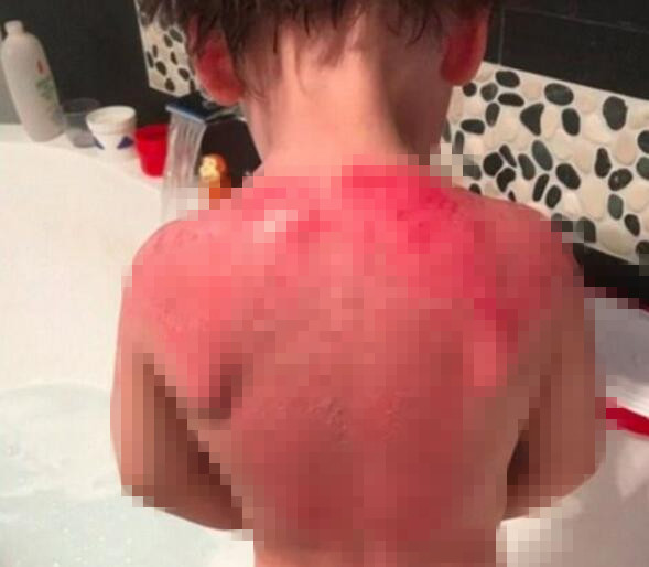 网红防晒霜事件 (澳洲防晒真的假的)