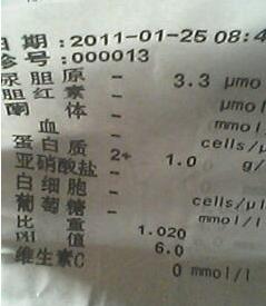 为什么很多人有尿蛋白,如何简单判断是否有尿蛋白