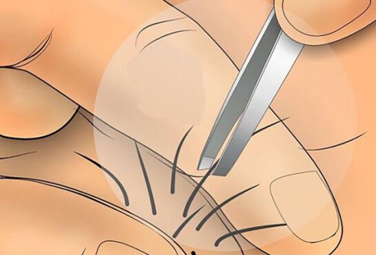 脱发怎么能止脱,脱毛脱发怎么办