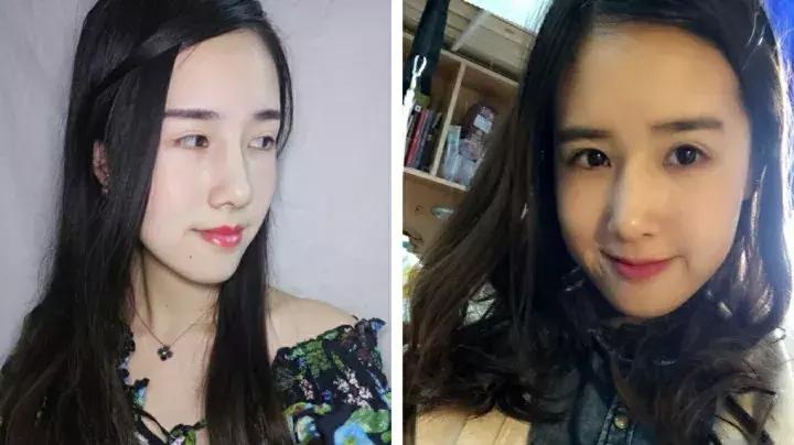 瘦脸美容仪器推荐,日本瘦脸神器有用吗