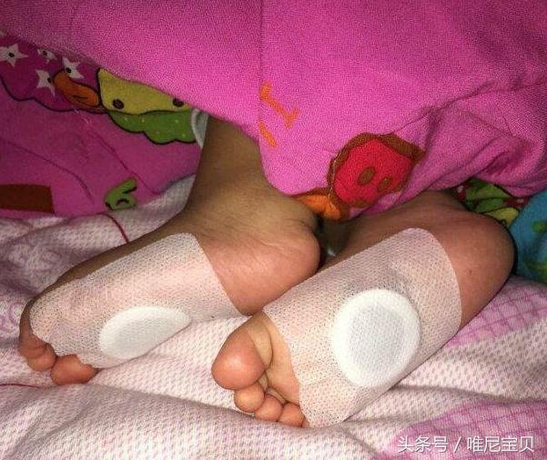 冬天宝宝受凉咳嗽快速止咳小妙招,秋冬季怎样合理避免孩子反复咳嗽