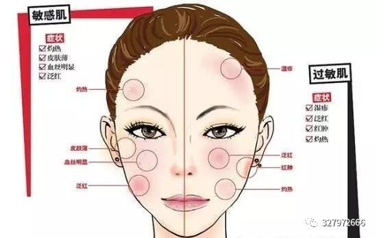 朵嘉浓会不会过敏,朵嘉浓能治脸过敏吗