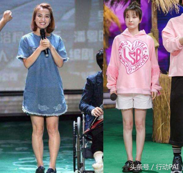 如何改善xo型腿让腿又细又长又直,腿不直o型腿的矫正方法