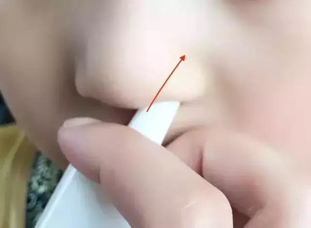 耳医生滴耳液正确使用方法,滴鼻药的正确姿势图解