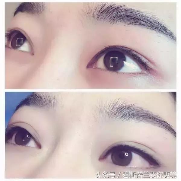 做的美瞳线发蓝是怎么回事,做美瞳线发蓝什么原因导致的
