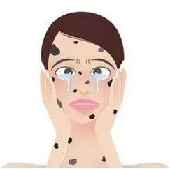 如何预防老年斑学会这几种方法,中老年人怎么去除老年斑