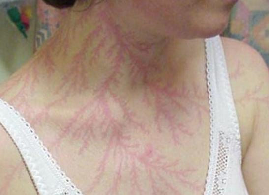 原来变性都不用去医院了,在家也能完成……