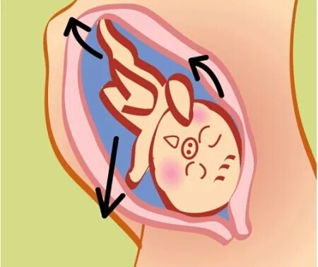 缺氧胎儿的求救信号胎动,胎宝宝的求救信号