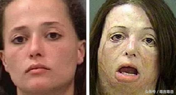 10个吸毒前后的惊人变化,吸毒的人吸毒前后对比图片