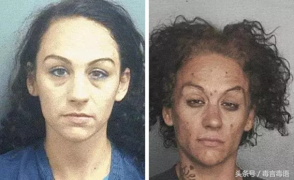 吸毒前后的变化对比,吸毒真的会毁容吗