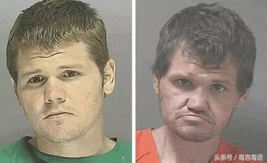 触目惊心吸毒前后真实的变化,吸毒的危害到底有多严重图片