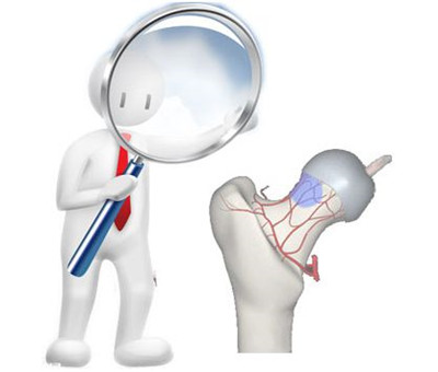 上海治疗关节置换术最好的医院,修复股骨头的最佳方法