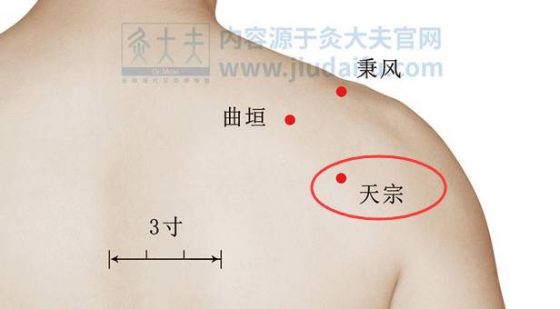 艾灸治疗肩周炎,是健康安全的优选方案