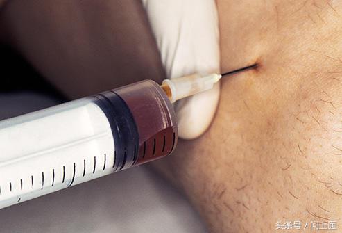 高中生膝盖疼痛的原因和解决方法,膝盖内侧靠下位置疼痛是什么原因