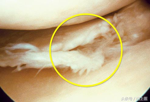 老年人膝盖疼痛的原因和解决方法,上楼梯膝盖疼痛的原因和解决方法