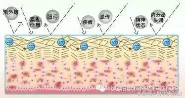 褐斑治疗,褐斑祛除方法