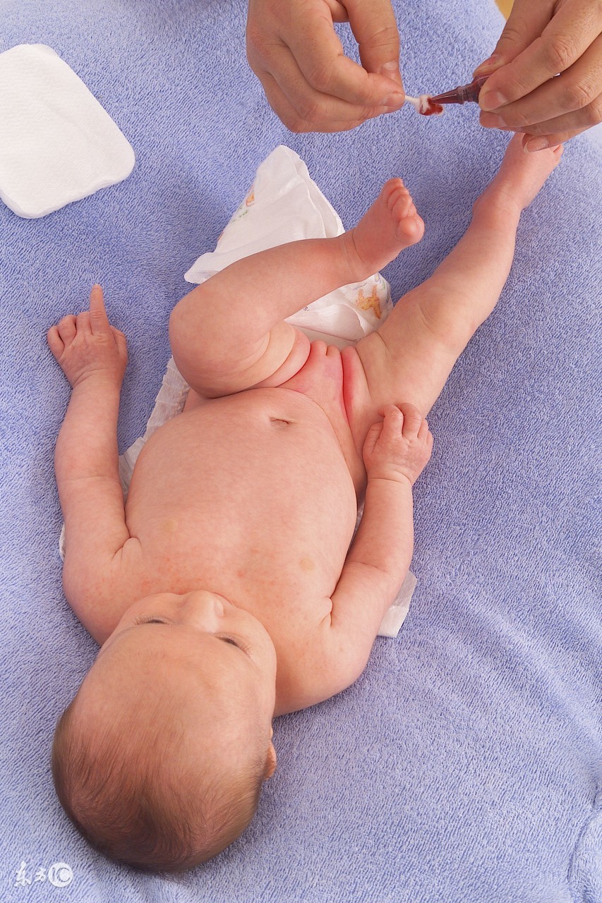 尿布疹快速消除小妙招,预防臀部尿布疹的神器