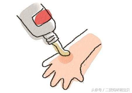 小孩子烫伤了怎么安慰她妈妈,孩子烫伤了怎么处理好得快