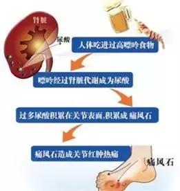 痛风是肾的问题还是肝问题,有关于痛风的问题
