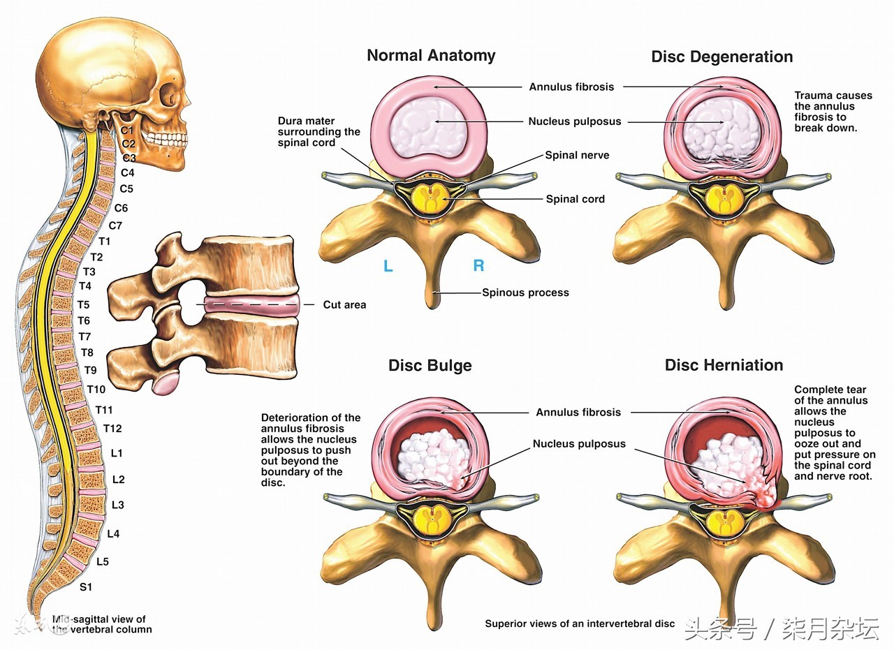 羽毛球康复,羽毛球腰部力量训练
