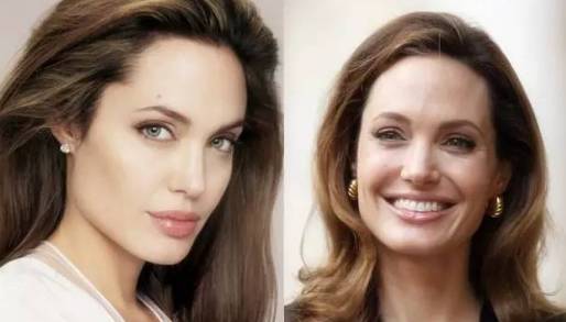 有黑眼圈细纹脂肪粒怎么办,去黑眼圈脂肪粒最有效的方法