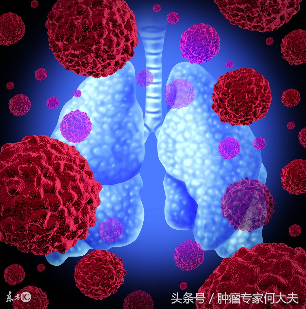 肺癌免疫治疗药物有副作用吗,肺癌免疫疗法副作用