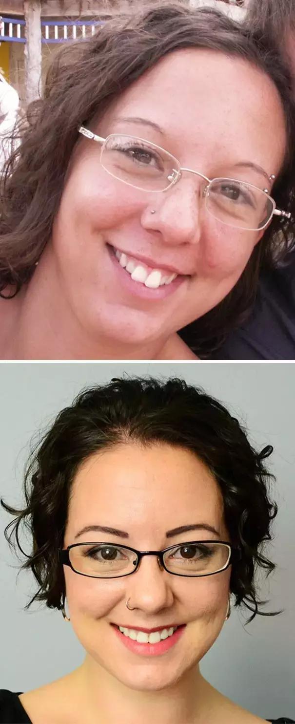 后悔整牙和不后悔整牙,整牙一般整到什么样就可以了