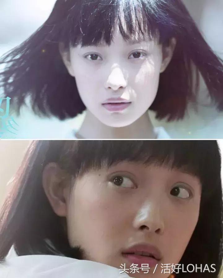 拯救发际线的生发神器,拯救发际线神器