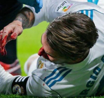 本泽马被巴西踢,本泽马打马竞