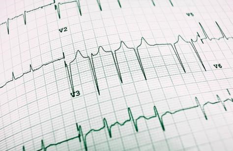 5年甲亢“斗争”，化验单堆叠成“小说”，甲亢“悲剧”何时休？